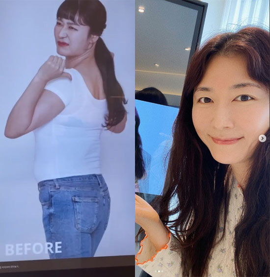 김미려, 10kg 다이어트 전 생각안나? "반가운 얼굴, 저 사람 누구야…