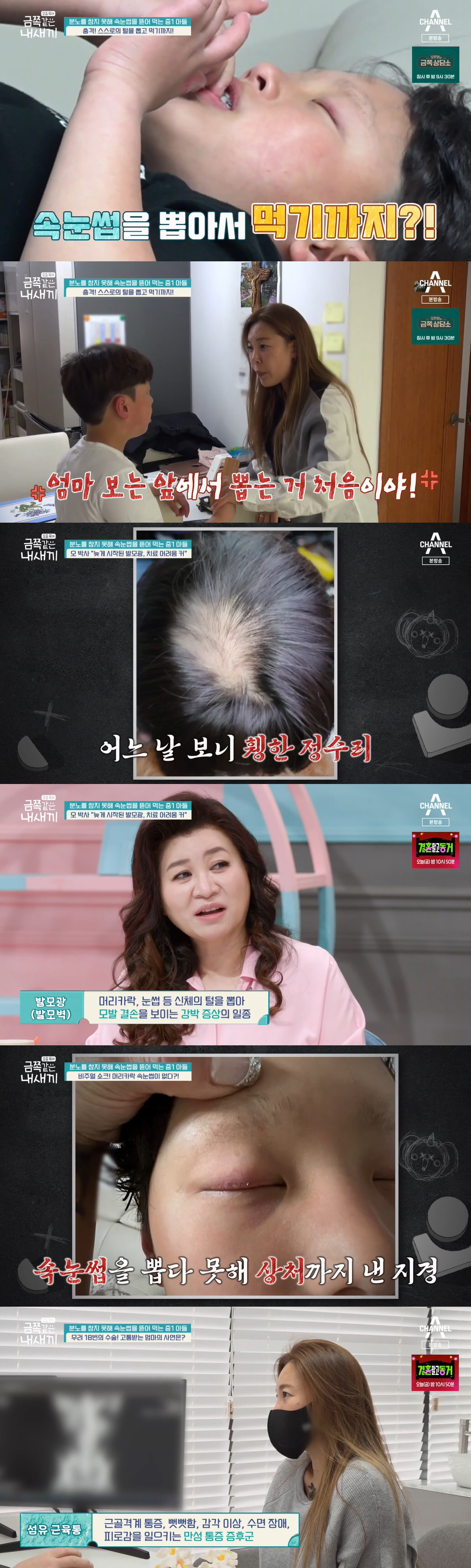 "죽는꼴 보고 싶어?" 금쪽이 막말에 할머니 실신→응급조치에 결국 '촬영…