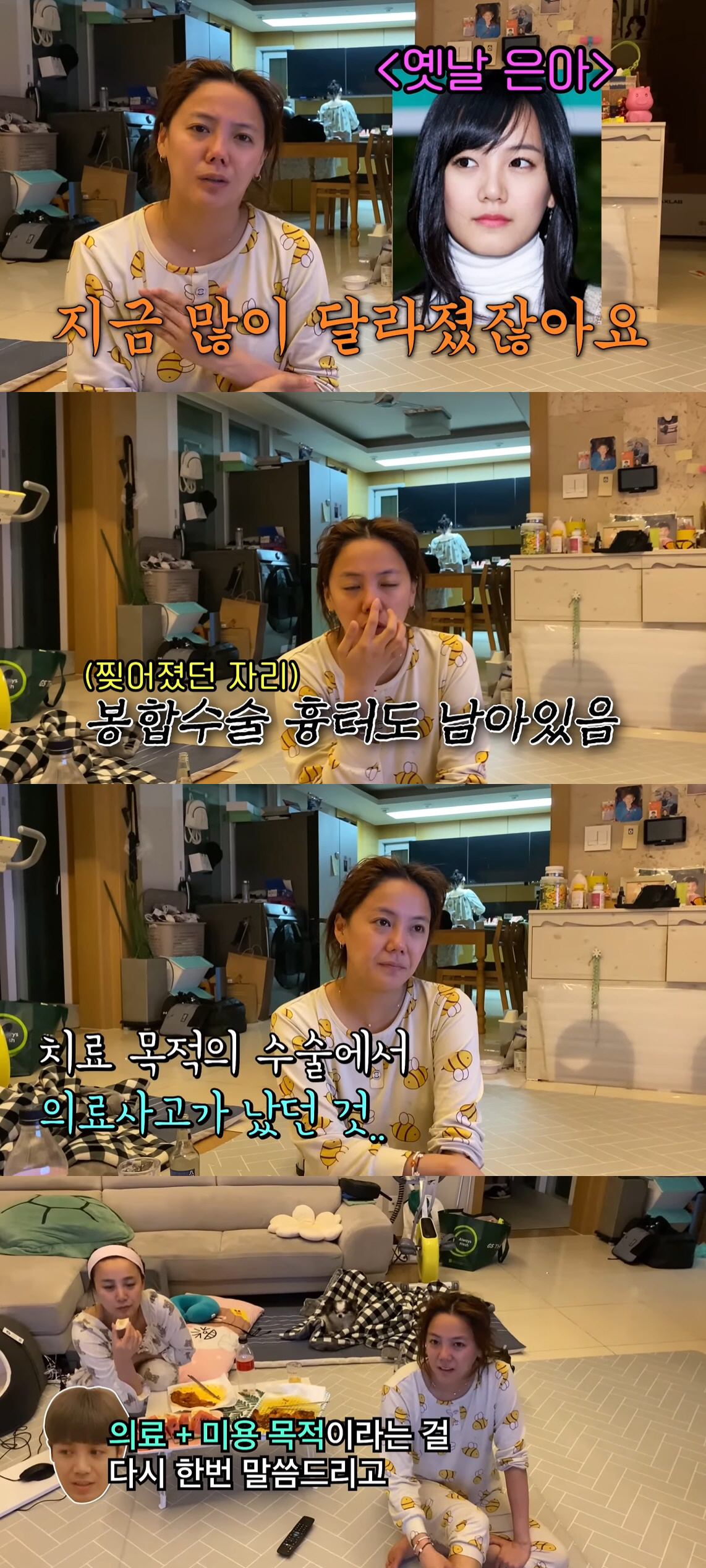 고은아, 의료사고 피해 고백 "마음고생 심했다…흉터도 남아" ('방가네'…