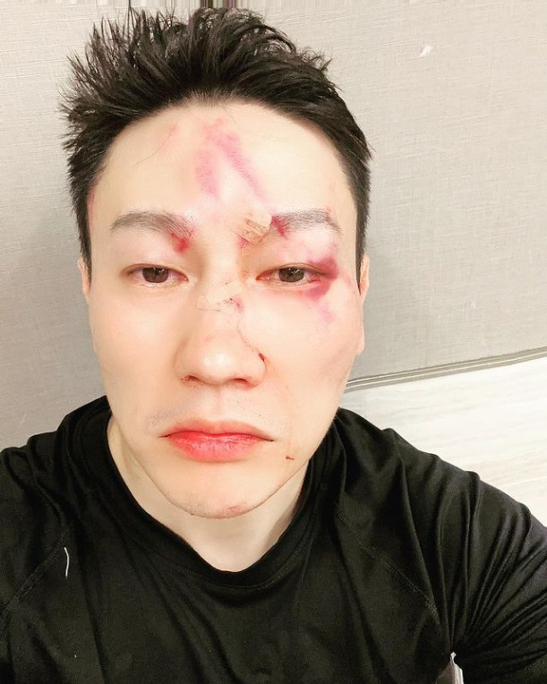 H유진, 日 선수에 TKO 패 '얼굴엔 피멍'…유승준 "리스팩 브라더"