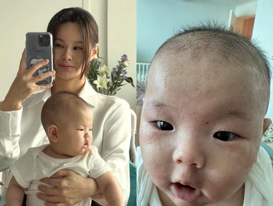 정성호♥경맑음 막내 子, 두드러기에 눈까지 퉁퉁 '총체적 난국'.."땅을…