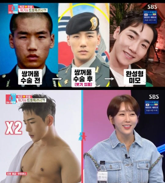 ‘한영♥’ 박군, 성형 전 후 얼굴 깜짝 공개..“쌍꺼풀+코수술 2번” …