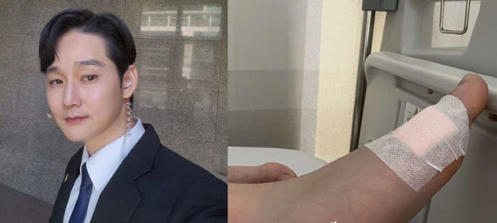 임강성, 독사 물려 입원→치료 중 상처 공개 "빠르게 쾌차할 것" [종합…