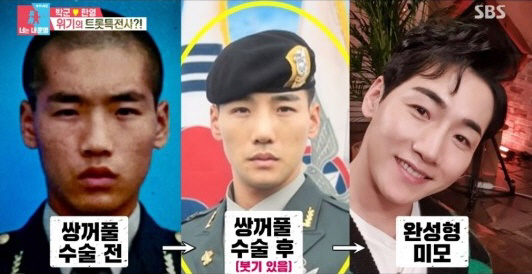 [SC이슈]박군→규현, 성형 전후 사진? 두렵지 않아...솔직당당 '성형…