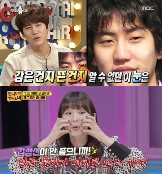 [SC이슈]박군→규현, 성형 전후 사진? 두렵지 않아...솔직당당 '성형…