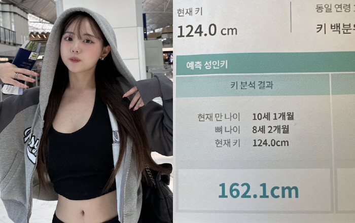 '148cm' 홍영기, 아들 예측 성인 키 162cm에 "성장호르몬 주사…