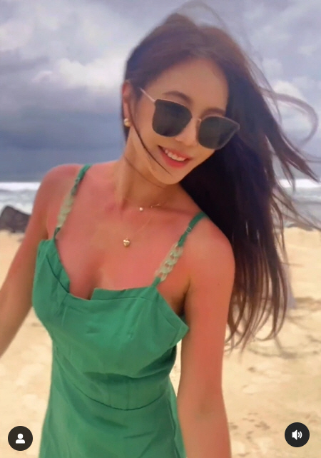 강예빈, 온 몸 화상 입었다 "한국 와서 링거만 3번"