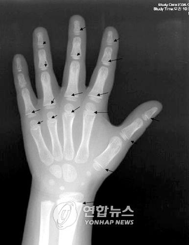[세브란스병원 제공. 재판매 및 DB 금지]