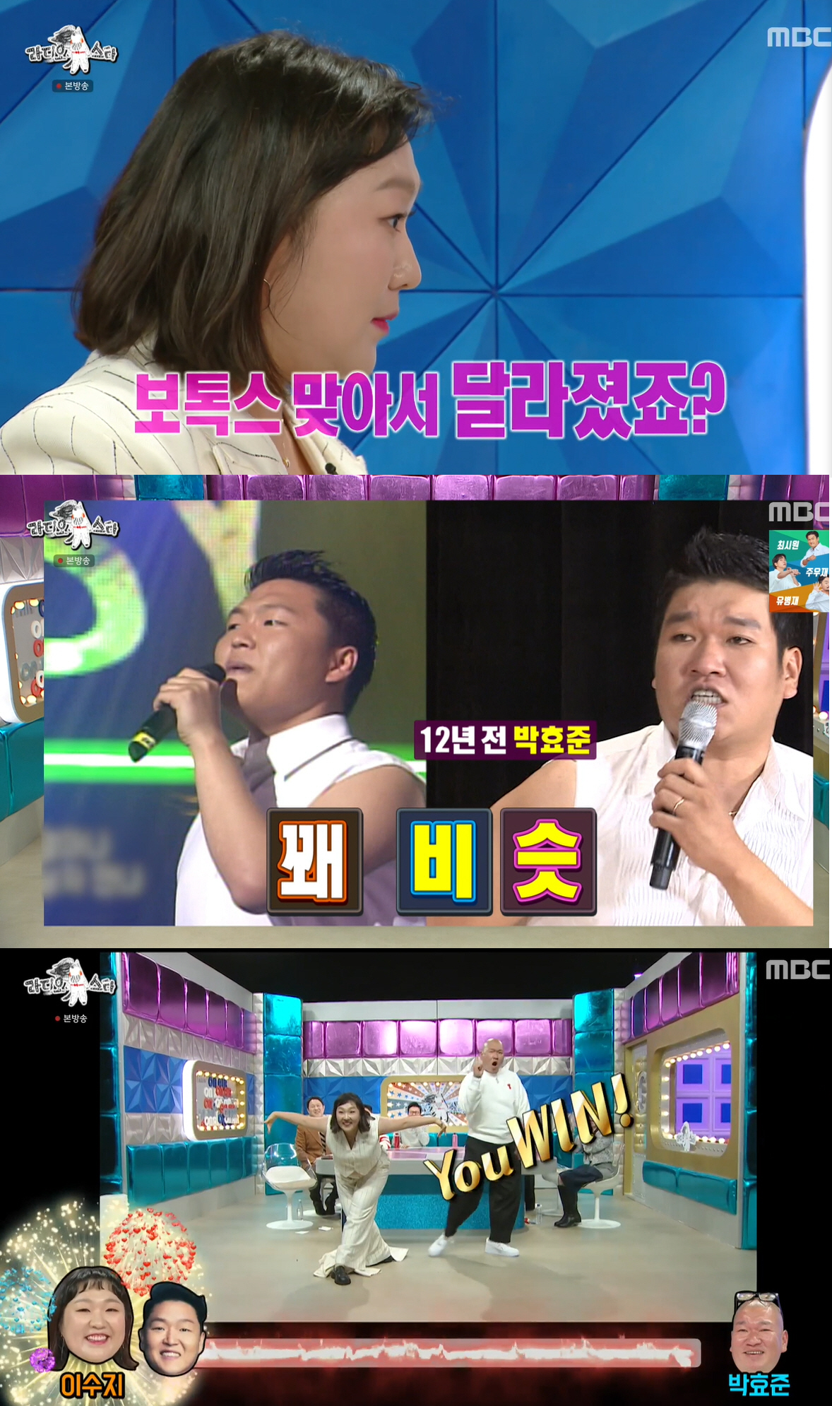 이수지, 보톡스 고백 "요즘 싸이 안 닮아" 파격 조끼 패션 뱃살도 '당…