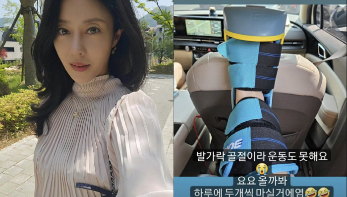 '싱글맘' 이지현, 침대 모서리에 부딪쳐 발가락 골절…"운동도 못해"