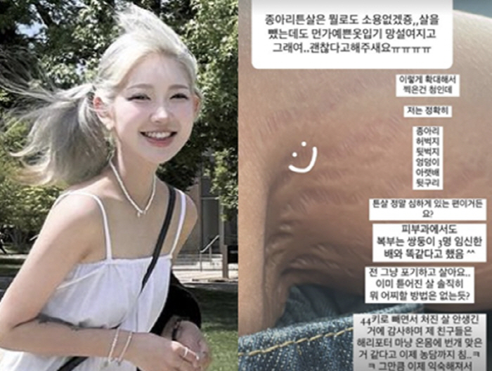 故 최진실 딸, "의사가 '세 쌍둥이 임신한 배' 같다고" 직접 공개한 …