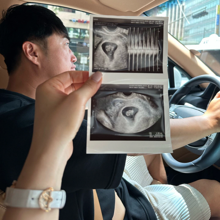 장동민, 두 아이 아빠 된다.."보물이 동생 생겼어요"