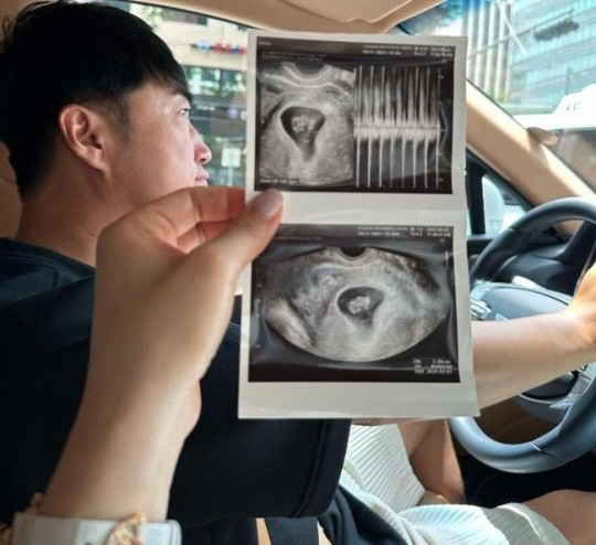 '6살 연하♥'장동민, 두 아이 아빠 된다…"#임밍아웃 #보물이 동생"