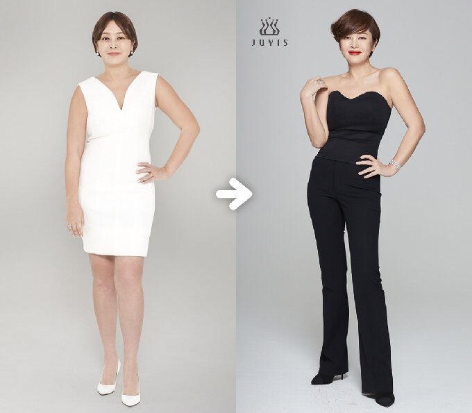 '10kg 감량' 이승연 "호르몬 탓 체중 급증, 안 먹을수록 붓더라" …