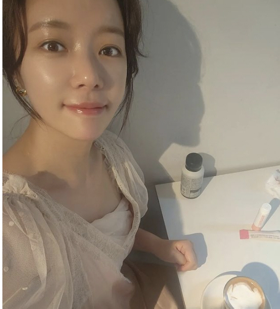 '이영돈♥' 황정음, 얼굴에서 '윤광이 차르르'…본인도 자랑한 "꿀피부"