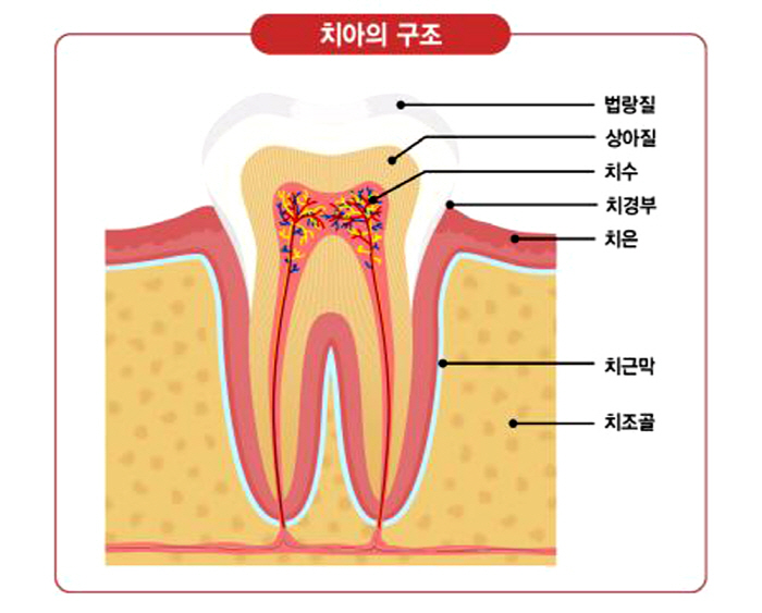 [헬스가이드-치통] 시린 이, 충치 등 원인…씹을 때 통증은 치아 금 등…