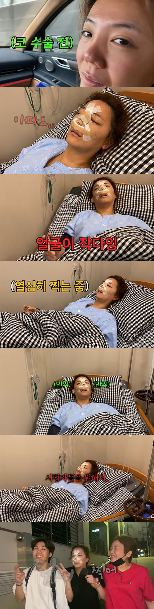 '코 성형수술' 고은아, 얼굴에 붕대 칭칭...그와중에 "찍어"(방가네)