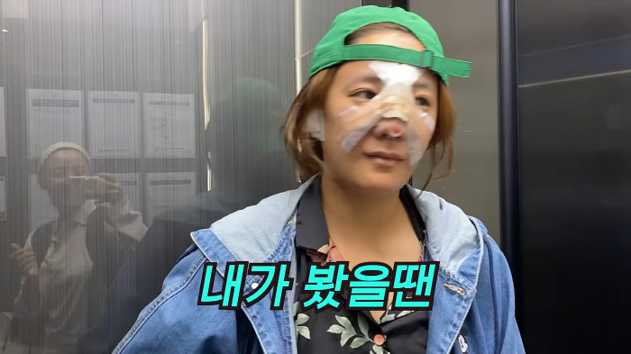 고은아, 벼르던 코 재수술 성공…"부목 대고 있어도 잘된게 보여" 만족감…
