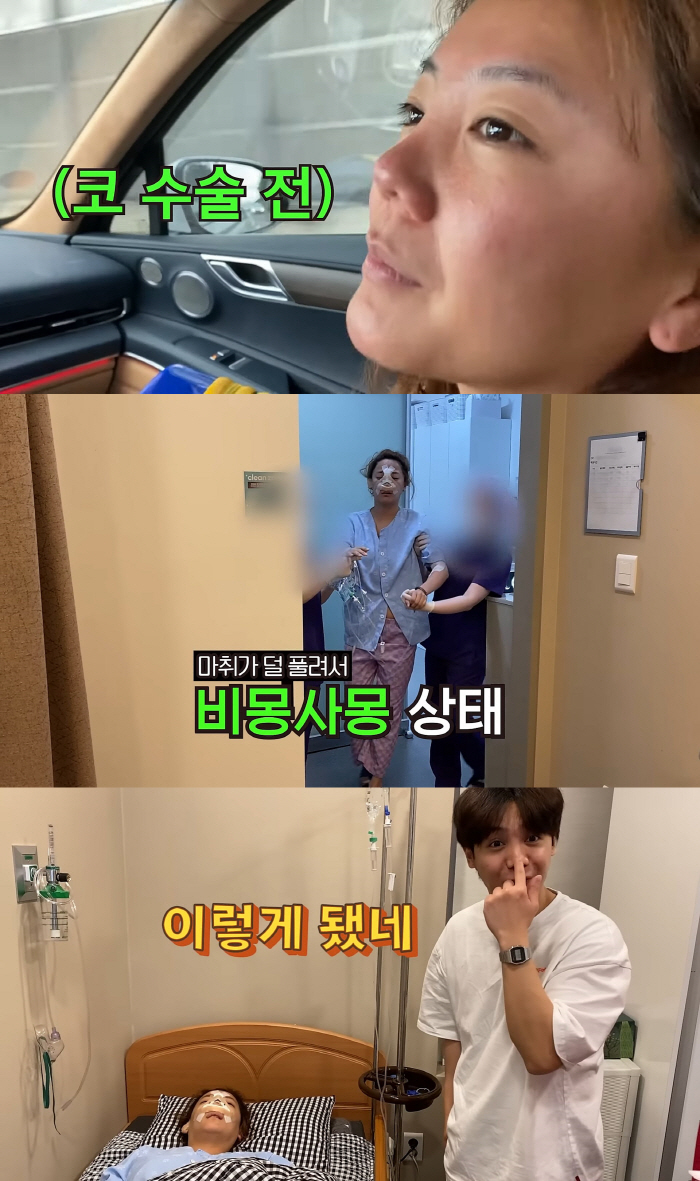 고은아, 벼르던 코 재수술 성공…"부목 대고 있어도 잘된게 보여" 만족감…