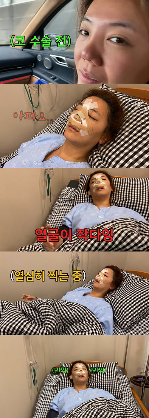 고은아, '중고차 값' 든다 던 '코 재수술' 성공적…미르 "진짜 코 잘…