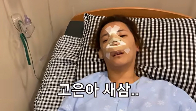 고은아, 의료사고로 무너진 코 재수술 성공 "볼드모트 아니야" [종합]