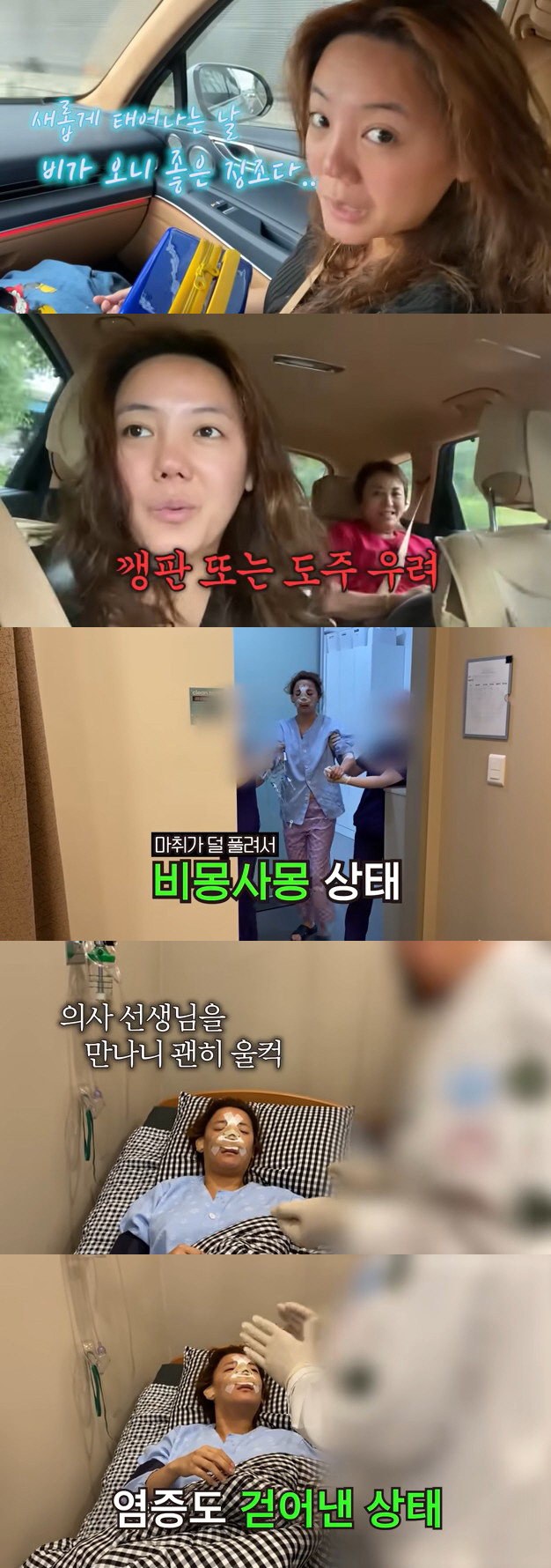 고은아, 의료사고로 무너진 코 재수술 성공 "볼드모트 아니야" [종합]