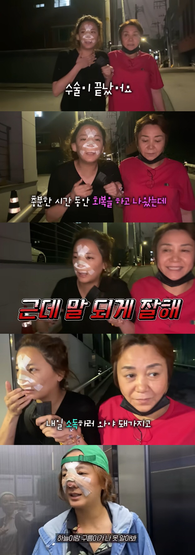 고은아, 의료사고로 무너진 코 재수술 성공 "볼드모트 아니야" [종합]
