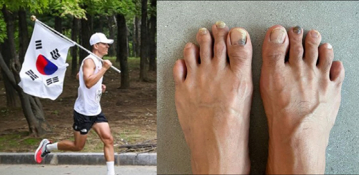 '정혜영♥' 션, 발톱 4개나 빠진 처참한 발 상태…"광복절 81.5km…