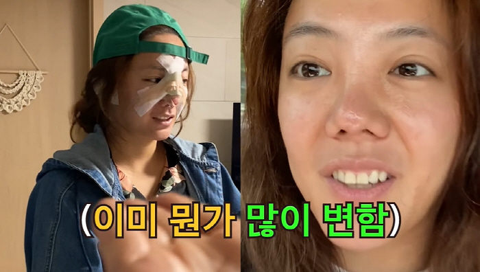 고은아, 만족스러운 코 수술 후기 "자동차 값 잘 들어갔다" ('방가네'…