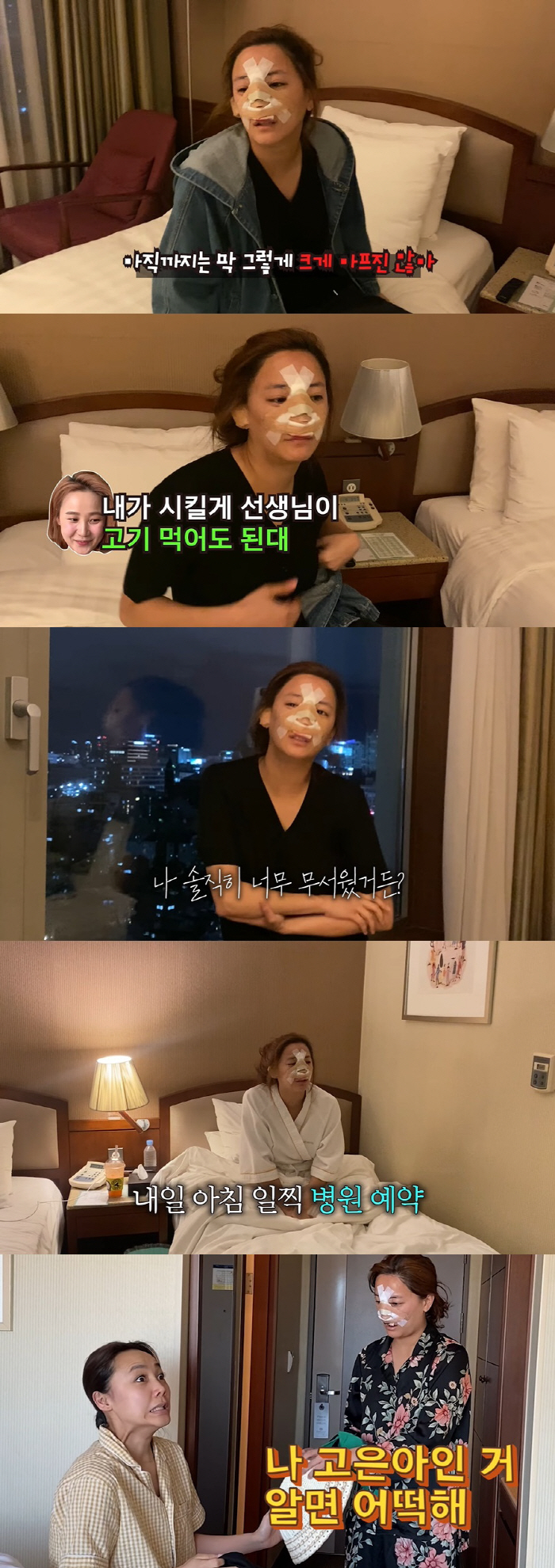 고은아, 만족스러운 코 수술 후기 "자동차 값 잘 들어갔다" ('방가네'…