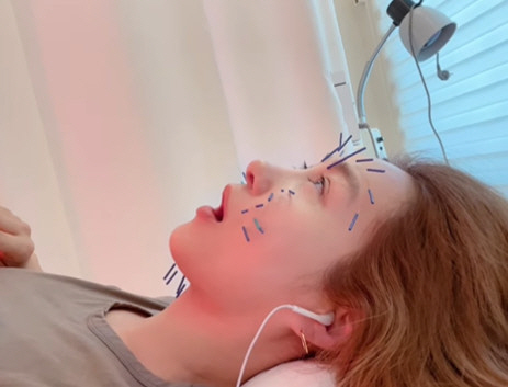 옥주현, 얼굴에 침 한 가득 꽂아도 평온…이걸 매일 하는 '자기관리 신'