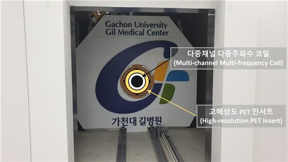 가천대 길병원 개발 중인 11.74T MRI 성과 기반 'PET-MRI …