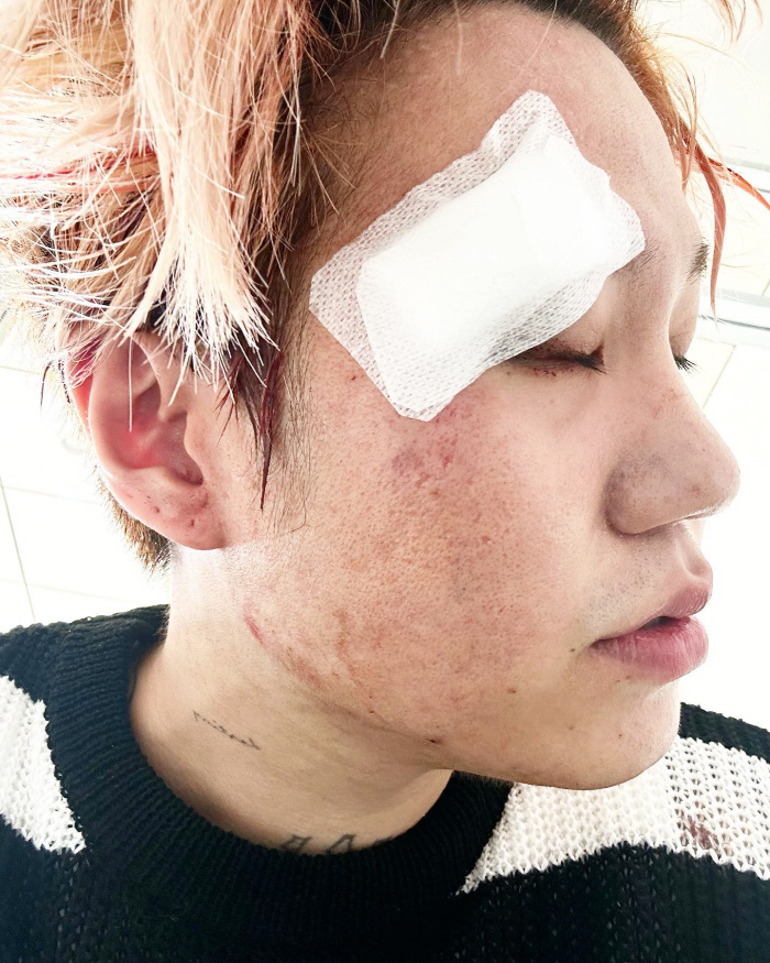 "크게 발작 일으킨후 기절했다"…'마약 기소유예' 래퍼 블루, 태국서 병…