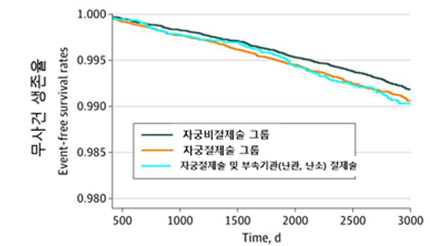 "조기 자궁절제술 받은 여성, 뇌졸중 발생률 30% 높아"