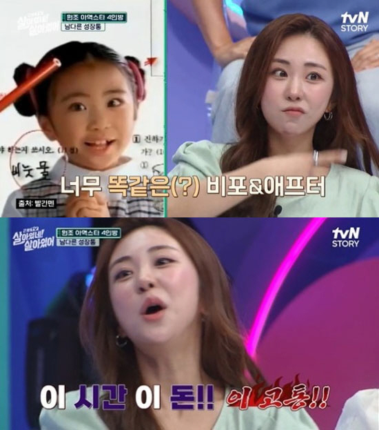 김성은 "코 성형 재수술까지 했는데 너무 똑같아…내 시간, 돈!" ('살…