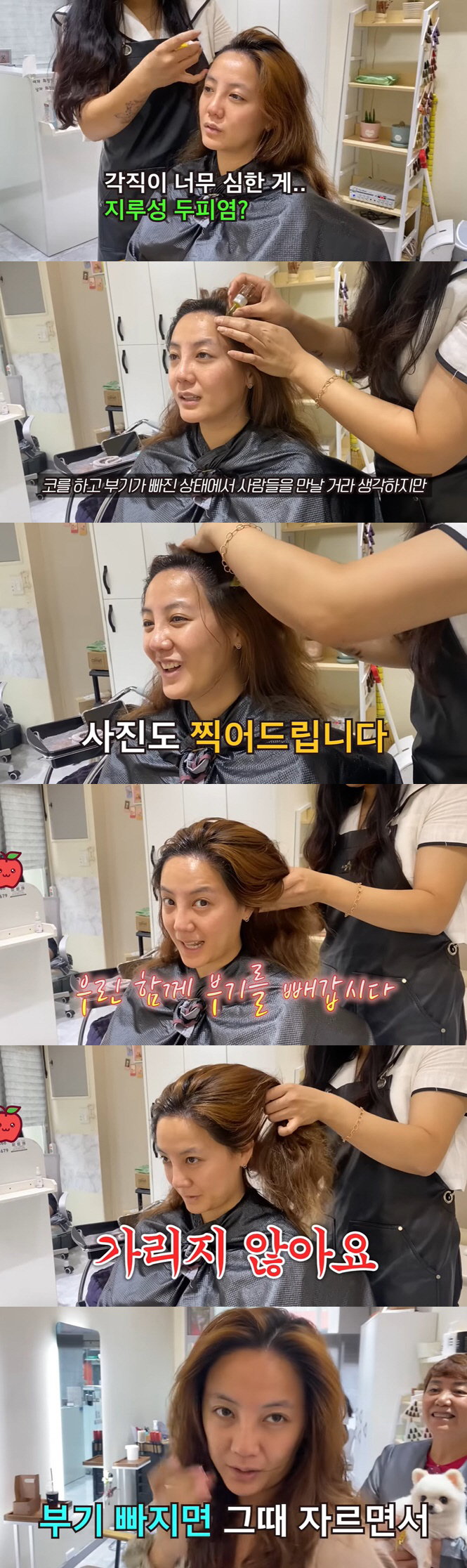 고은아, 재수술한 코 부기 안 빠졌는데.."사진 박제까지, 다들 놀랄 것…