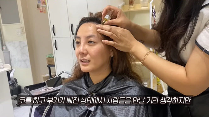 고은아, '차 한 대 값' 코 수술 후 근황..."부기 안 빠져도 당당 …