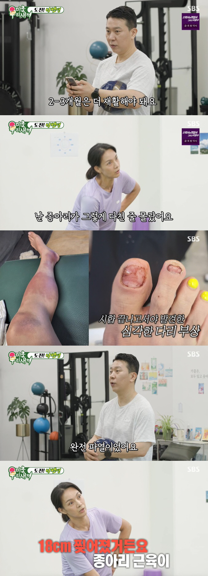 박선영, 심각했던 다리 부상 "종아리 근육 18cm 찢어져, 완전 파열"…