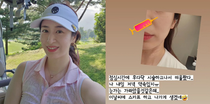'주진모♥' 민혜연, 점심시간에도 셀프 시술 "이 날씨에 스카프 하게 생…
