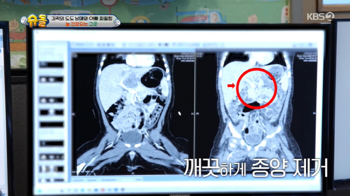 최필립 오열 "생후 4개월 子, 간암 진단...항암치료+7개월에 간 절제…