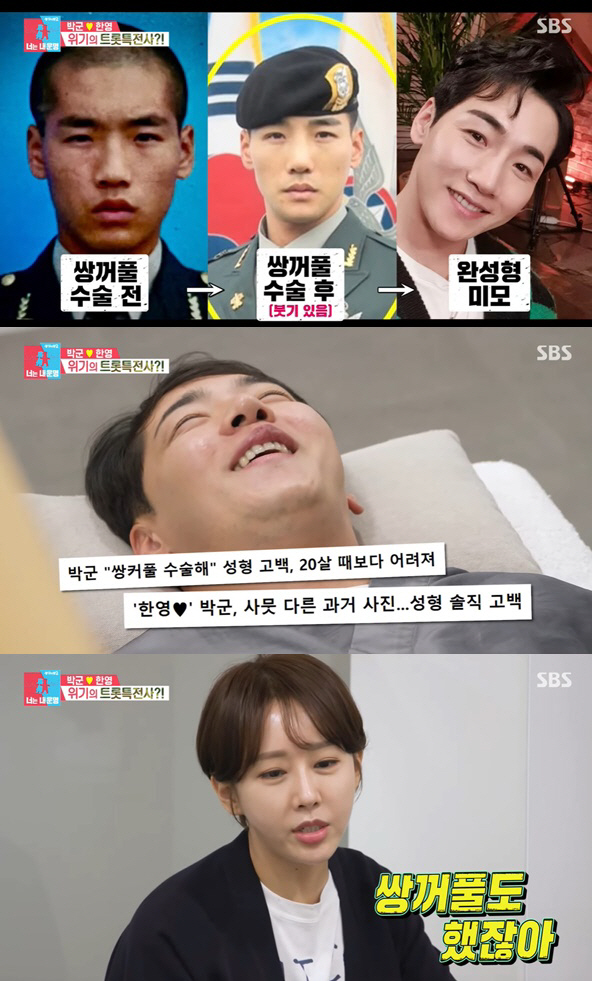 "코 휘는 부작용·중형차 값 수술비" 홍수아→고은아, 솔직한 '★성형 고…
