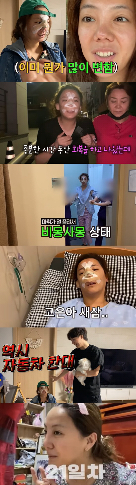 "코 휘는 부작용·중형차 값 수술비" 홍수아→고은아, 솔직한 '★성형 고…