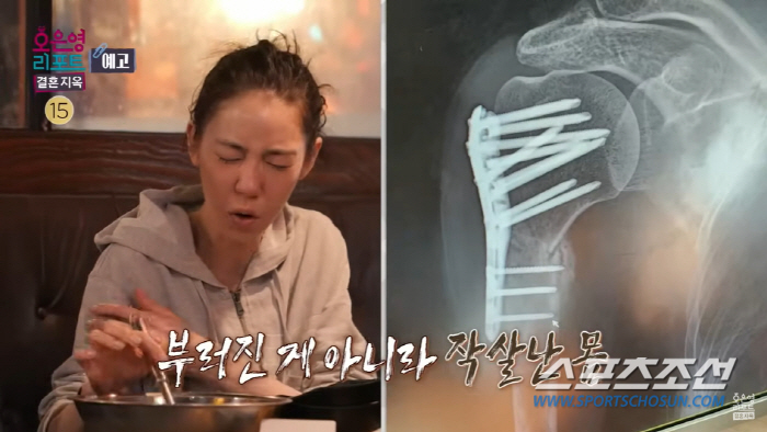 배우 이소정, 우울증·조울증·공황장애·불안장애까지…술로 고통 견디는 생활…