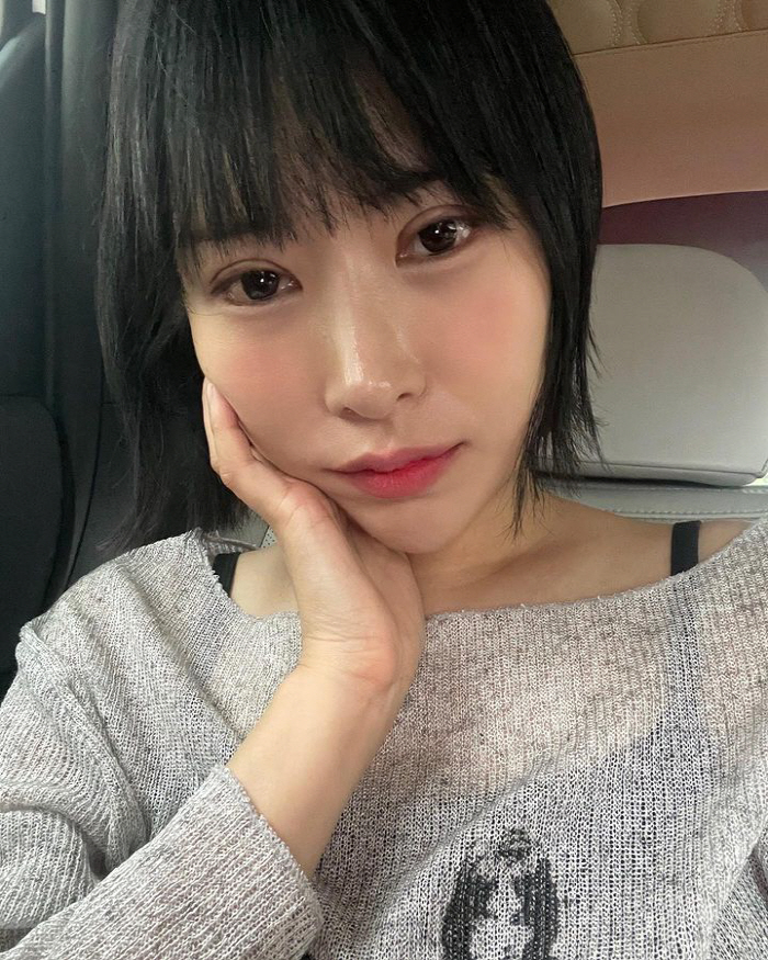 이세영, 쌍꺼풀 또 했나?…퉁퉁 부은 눈 "2년전에 했다더니"
