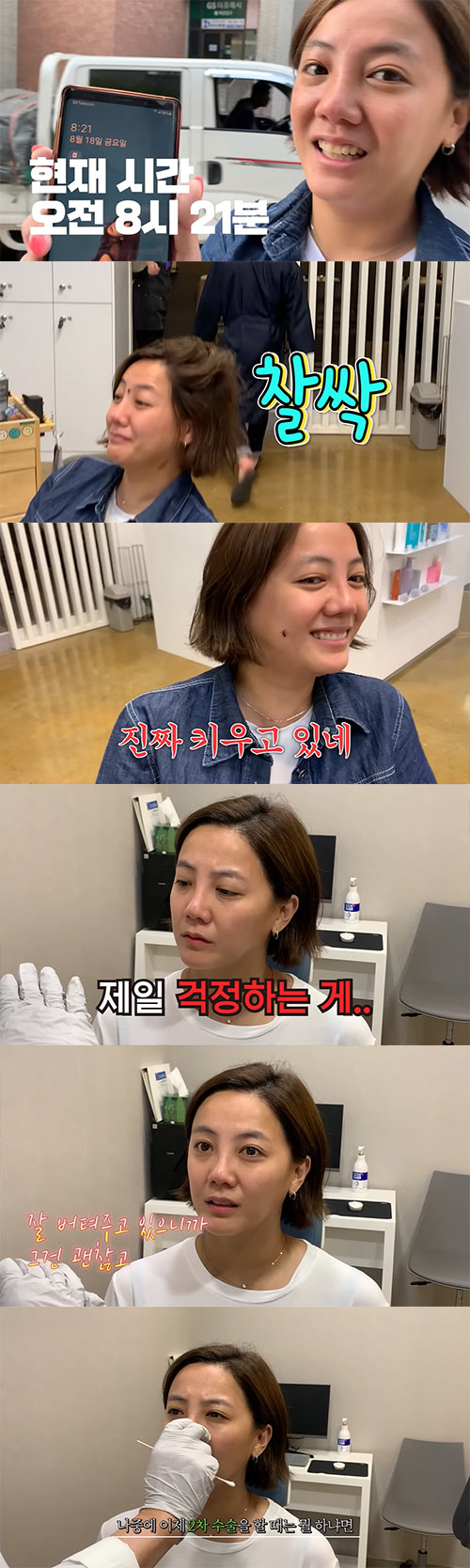고은아, '중고차 값' 든다 던 코 성형 후기…2차 성형 예고까지(방가네…