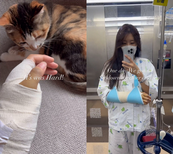 현아, 낙마사고 '충격'…얼굴에 온통 피멍 "상태가 처절했다"