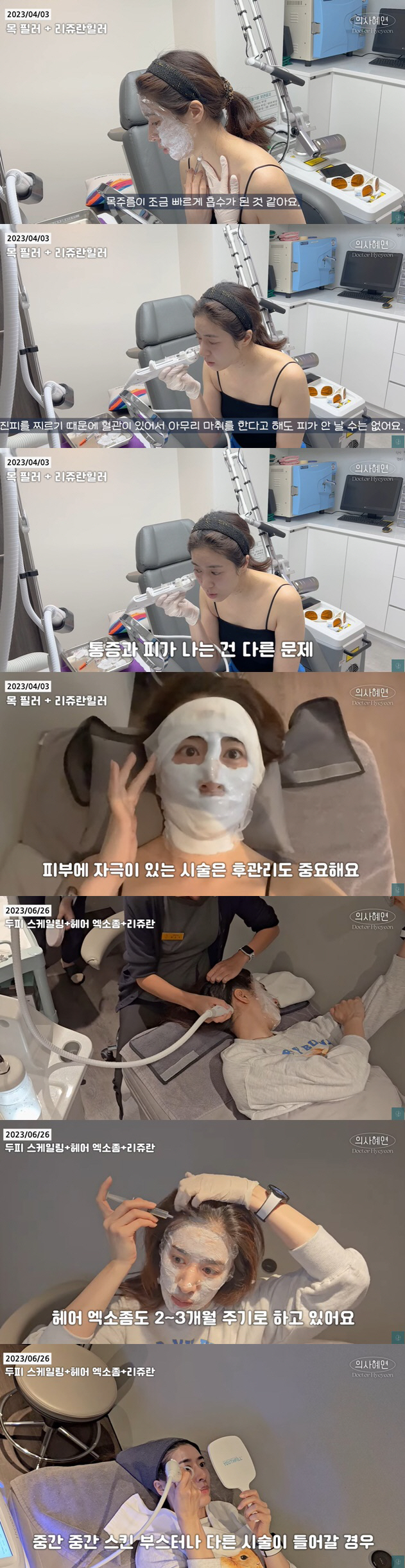 '주진모♥' 민혜연, 직접 목주름+피부에 시술 "피 나는 건 정상적인 과…