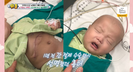 최필립, '소아암 투병' 子 수술 흉터에 "영광의 상처, 암 이겨냈다" …