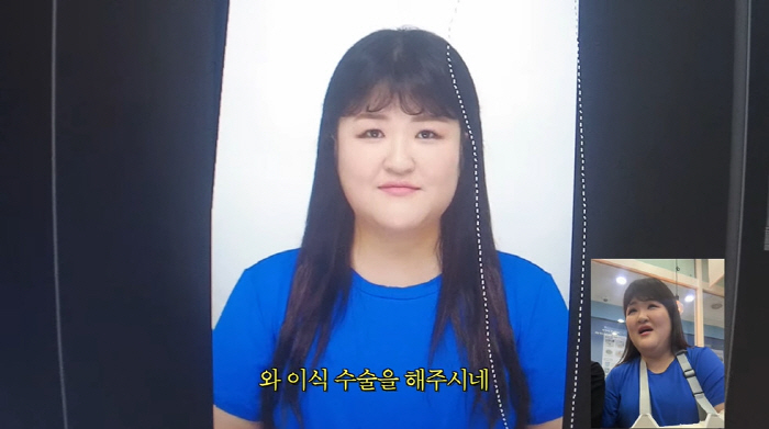 이국주, 증명사진 촬영 중 머리 이식 수술 "머리 안 심었어도 됐겠다" …