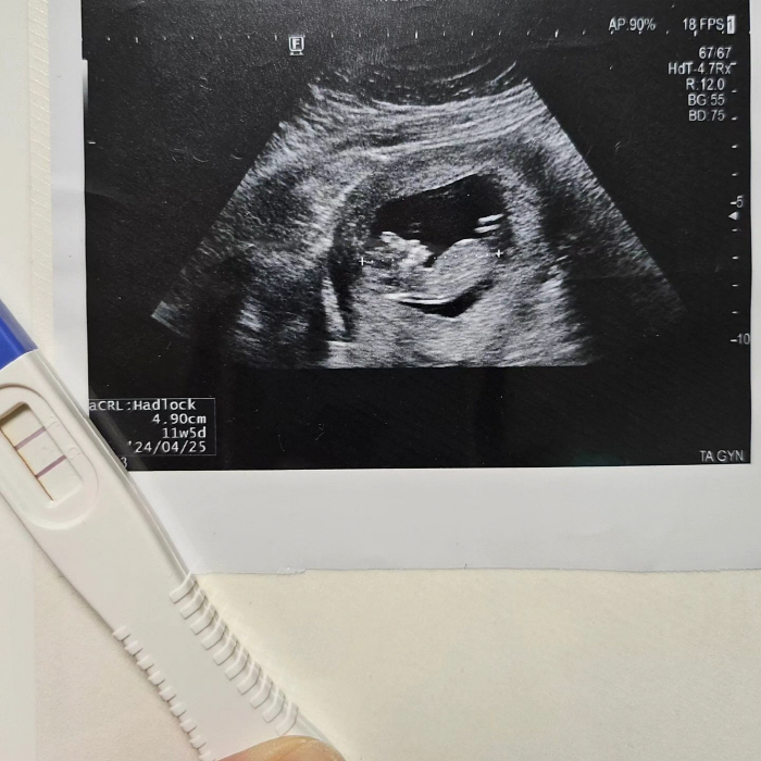 '꼬마 요리사' 노희지, 결혼 7년 만에 이민 "기적 같은 존재 나타나"…